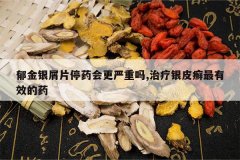 <b>������мƬͣҩ���������,������ƤѢ����Ч��ҩ</b>