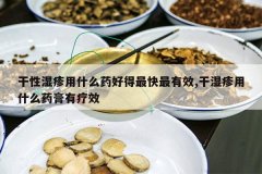 <b>����ʪ����ʲôҩ�õ��������Ч,��ʪ����ʲôҩ������Ч</b>