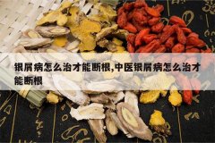 <b>��м����ô�β��ܶϸ�,��ҽ��м����ô�β��ܶϸ�</b>